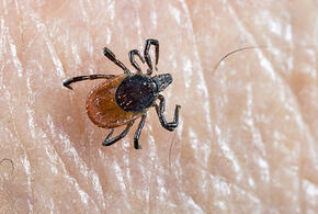 Инфицированные клещи покусали детей и взрослых на Кубани