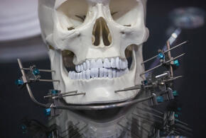 Какие простые продукты неожиданно защитят зубы от кариеса?