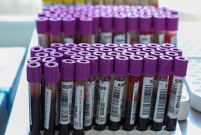 Анализ крови