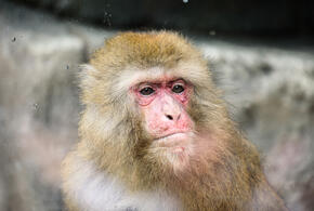 Пациент госпитализирован с высыпаниями и высокой температурой