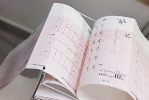 Кардиограмма