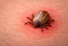 История синдрома альфа‑гал, и почему он может коснуться каждого